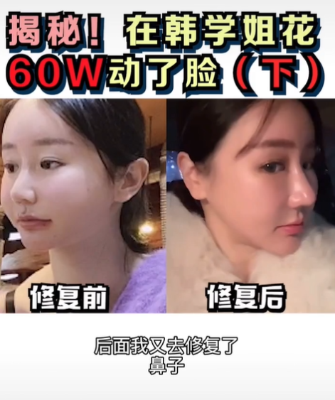 女子诈骗150万后整容换脸潜逃，道德、法律与人性之探讨案例分析
