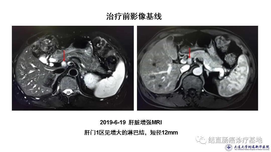 最新CT技术革新，重塑医疗影像学的未来