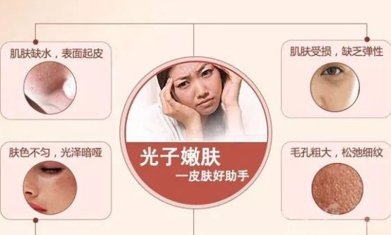 光子嫩肤价格详解，全面指南与选择建议