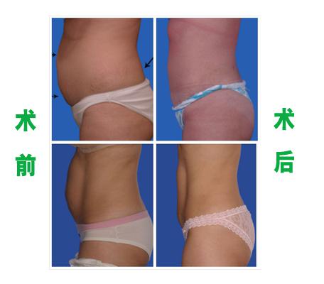第140页